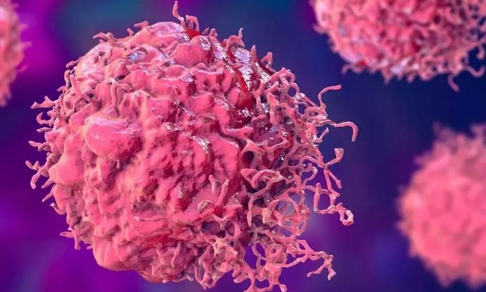 Kanser-Hucreleri Kanser hücreleri, normal hücrelerin genetik materyalinde meydana gelen mutasyonlar sonucunda ortaya çıkar. İnsan vücudu, sürekli olarak hücrelerini yenileyen bir yapıya sahiptir ve bu hücrelerin bölünmesi sıkça gerçekleşir.