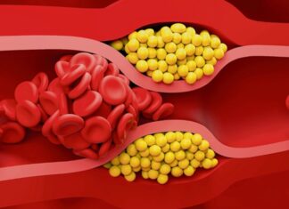 Kalp ve damar sağlığını doğrudan etkileyen konular arasında ilk sıralarda yer alan kolesterol, çoğu zaman kötü bir şeymiş gibi algılansa da aslında vücudun temel yapı taşlarından biridir. Hücre zarlarının yapısında bulunan, hormon üretiminde görev alan ve D vitamini sentezine yardımcı olan bu yağ benzeri madde, yalnızca gıdalarla alınmaz; karaciğer tarafından da üretilir. Ancak vücutta belli seviyelerin üzerine çıktığında ciddi sağlık problemlerine yol açabilir. Bu nedenle kolesterolün ne olduğu, neden yükseldiği ve hangi değerlerin tehlikeli kabul edildiği, toplum sağlığı açısından hayati bir önem taşır. Konulu bir haber görseli.