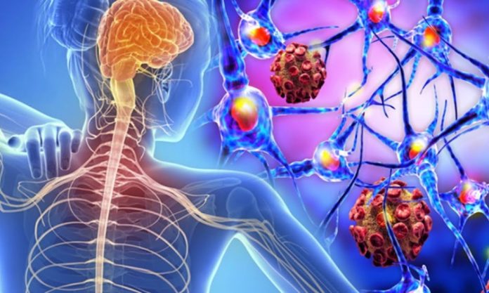 Multipl Skleroz (MS), merkezi sinir sistemini etkileyen ve bağışıklık sisteminin sinir hücrelerine zarar vermesiyle karakterize edilen kronik bir hastalıktır. Beyin ve omurilikteki sinir liflerinin etrafını saran miyelin kılıfının tahrip olmasıyla oluşan bu durum, bilgi akışının kesintiye uğramasına ve ciddi nörolojik sorunlara yol açar. Hastalık, genellikle genç erişkinlerde başlar ve yaşam boyu sürebilir. Erken tanı ve uygun tedaviyle hastalığın etkileri azaltılabilmektedir. Konulu bir haber görseli.