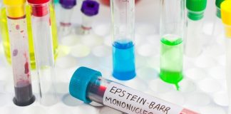 Mononükleoz, halk arasında “öpücük hastalığı” olarak da bilinen ve genellikle Epstein-Barr virüsü (EBV) nedeniyle ortaya çıkan bulaşıcı bir hastalıktır. Bu hastalık çoğunlukla genç bireylerde görülür ve özellikle ergenlik dönemindeki kişiler arasında yaygınlık kazanır. Bu yaygınlığın birçok biyolojik, davranışsal ve çevresel nedeni bulunmaktadır. Bağışıklık sistemi, hijyen koşulları, sosyal alışkanlıklar ve vücut direnci, hastalığın görülme sıklığını etkileyen başlıca faktörler arasındadır. Konulu bir haber görseli.